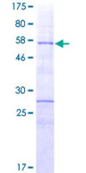 SDS-PAGE - Recombinant Human HOXA9 protein (GST tag N-Terminus) (AB152453)