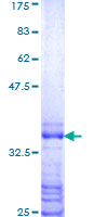 Recombinant Human HOXB8 protein