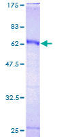 SDS-PAGE - Recombinant Human HOXC9 protein (AB158683)