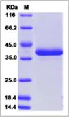 SDS-PAGE - Recombinant Human HP-3 protein (Fc Chimera) (AB276637)