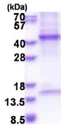 SDS-PAGE - Recombinant Human HPR protein (His tag N-Terminus) (AB177664)