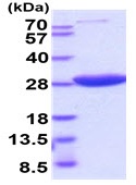 SDS-PAGE - Recombinant human HPRT protein (Active) (His tag N-Terminus) (AB222951)