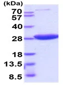 SDS-PAGE - Recombinant human HPRT protein (Active) (AB222951)