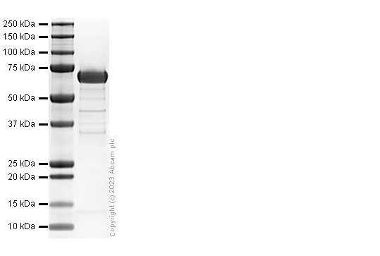 Recombinant Human HPSE Protein (His tag)