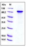 SDS-PAGE - Recombinant Human HRG protein (His tag) (AB276324)