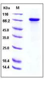 SDS-PAGE - Recombinant Human HRG protein (His tag) (AB276324)