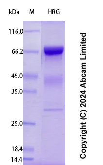 SDS-PAGE - Recombinant Human HRG Protein Standard (AB323050)