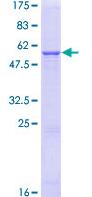 SDS-PAGE - Recombinant Human HSD11B1 protein (AB114301), expandable thumbnail