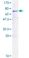 SDS-PAGE - Recombinant Human HSD11B2 protein (AB132442)