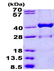 SDS-PAGE - Recombinant Human HSD17B1 protein (His tag N-Terminus) (AB156332)