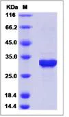 SDS-PAGE - Recombinant Human HSD17B14 protein (His tag) (AB276634)