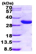 SDS-PAGE - Recombinant Human HSD17B14 protein (His tag N-Terminus) (AB101209)