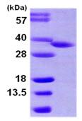 SDS-PAGE - Recombinant Human HSD17B8 protein (AB105611), expandable thumbnail