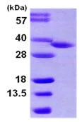 SDS-PAGE - Recombinant Human HSD17B8 protein (His tag N-Terminus) (AB105611)