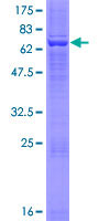 Recombinant Human HSD3B2 protein