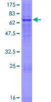 SDS-PAGE - Recombinant Human HSD3B2 protein (GST tag N-Terminus) (AB114766)