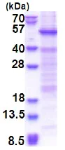 SDS-PAGE - Recombinant Human HSFY1 protein (denatured) (His tag N-Terminus) (AB174423)