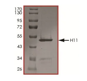 SDS-PAGE - Recombinant Human Hsp22/HSPB8 protein (Tagged) (AB268608)