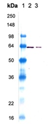 Western blot - Recombinant Human Hsp60 protein (AB113177)