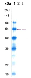 Western blot - Recombinant Human Hsp60 protein (AB113177)