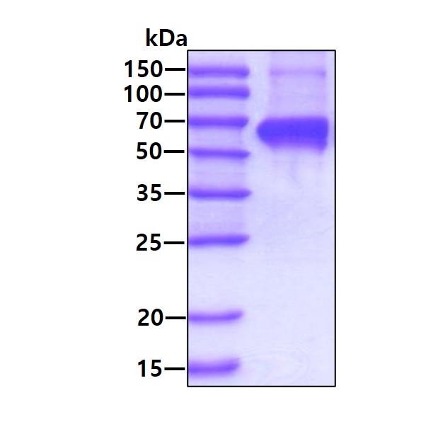 SDS-PAGE - Recombinant Human Hsp60 protein (AB78792)