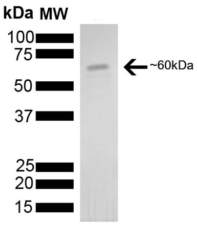 SDS-PAGE - Recombinant human Hsp60 protein (His tag N-Terminus) (AB78430)