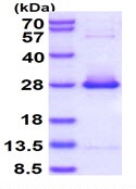 SDS-PAGE - Recombinant Human HSPB2 protein (AB126686), expandable thumbnail