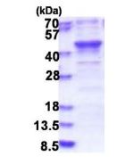 SDS-PAGE - Recombinant Human HSPC142 protein (AB183249), expandable thumbnail