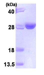 SDS-PAGE - Recombinant Human HSPC150/UBE2T protein (His tag C-Terminus) (AB95318)