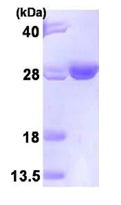 SDS-PAGE - Recombinant Human HSPC150/UBE2T protein (His tag C-Terminus) (AB95318)