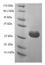 Recombinant Human HSPC152 protein (Tagged)