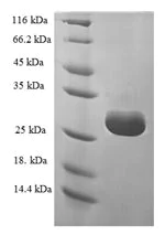 SDS-PAGE - Recombinant Human HSPC152 protein (Tagged) (AB239546)