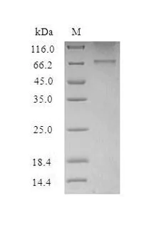 SDS-PAGE - Recombinant Human HTR2B Protein (His Tag) (AB314620)