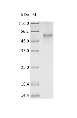 SDS-PAGE - Recombinant Human HTR7 Protein (His Tag) (AB314621)