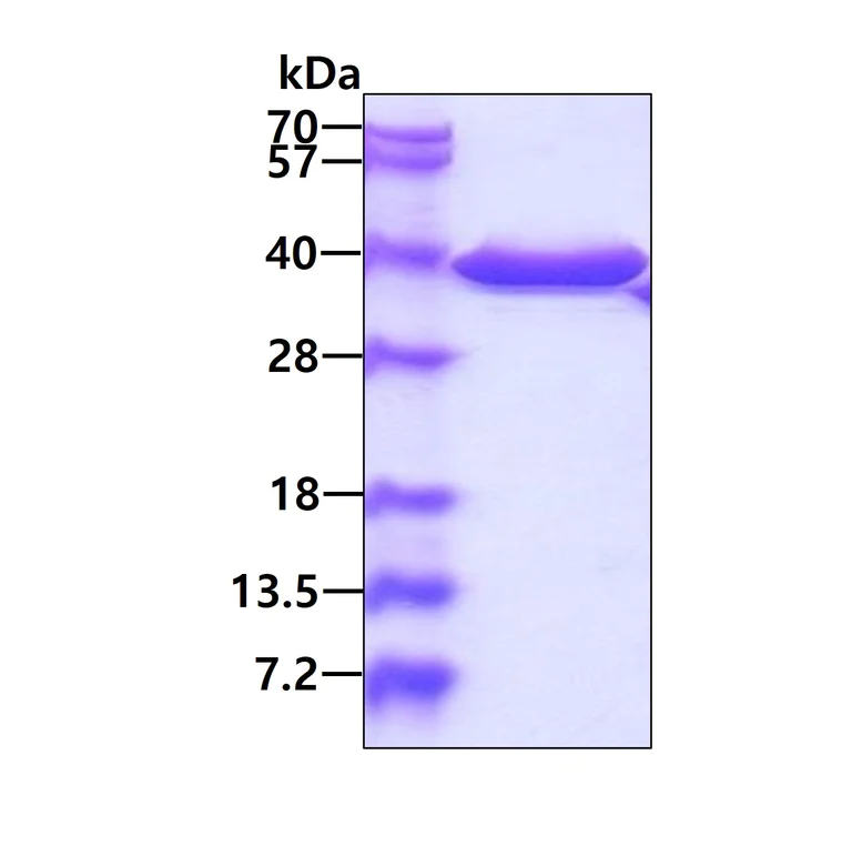 SDS-PAGE - Recombinant Human HtrA2 / Omi protein (His tag C-Terminus) (AB48747)