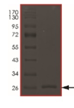Recombinant Human HtrA3 protein (His tag)