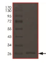 SDS-PAGE - Recombinant Human HtrA3 protein (His tag) (AB217828)