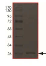 SDS-PAGE - Recombinant Human HtrA3 protein (His tag N-Terminus) (AB217828)
