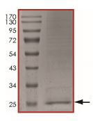 SDS-PAGE - Recombinant Human htrA4 protein (AB190385), expandable thumbnail