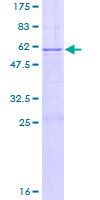 SDS-PAGE - Recombinant Human HYAL1 protein (AB112304), expandable thumbnail