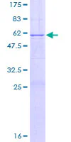 SDS-PAGE - Recombinant Human HYAL1 protein (GST tag N-Terminus) (AB112304)
