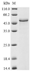 SDS-PAGE - Recombinant Human HYAL2 protein (AB289782)