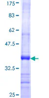 SDS-PAGE - Recombinant Human HYAL2 protein (GST tag N-Terminus) (AB152907)