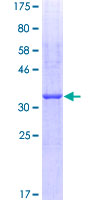 SDS-PAGE - Recombinant Human Hyaluronan synthase 2 protein (GST tag N-Terminus) (AB158635)