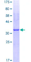 SDS-PAGE - Recombinant Human Hyaluronan synthase 2 protein (GST tag N-Terminus) (AB158635)
