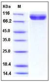 SDS-PAGE - Recombinant Human I100 protein (His tag) (AB276362)