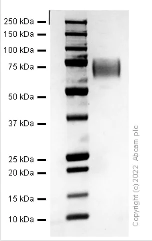 SDS-PAGE - Recombinant Human ICAM1 Protein (AB307352)