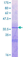 Recombinant Human ICAM5 protein