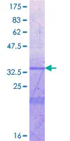 SDS-PAGE - Recombinant Human ICAM5 protein (GST tag N-Terminus) (AB159710)