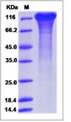 SDS-PAGE - Recombinant Human ICAM5 protein (His tag) (AB276709)